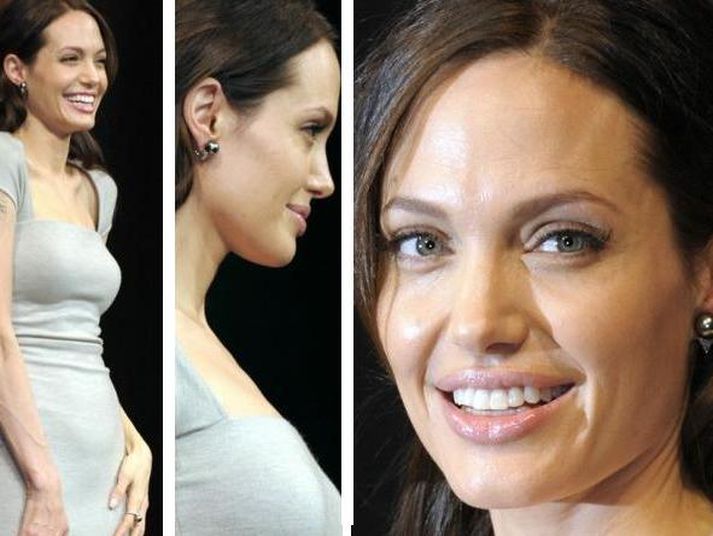 Angelina Jolie.