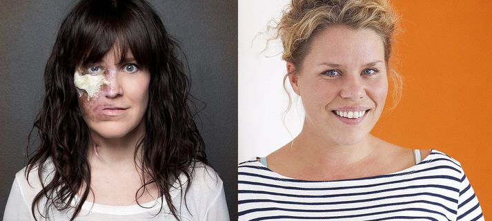 Unnur Ösp Konráðsdóttir, leikkona, og Inga Dóra Pétursdóttir, framkvæmdastýra UN Women