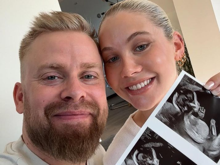 Ásgeir og Hildur eiga von á stúlku í haust.