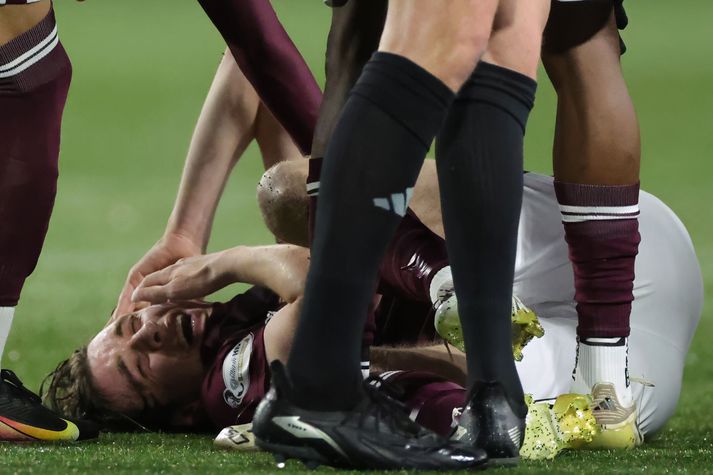 Tómas Bent Magnússon fékk þungt högg og kinnbeinsbrotnaði í leik Hearts á móti Kilmarnock.