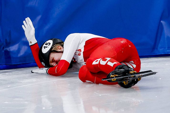 Það fossblæddi úr hinni pólsku Kamilu Sellier-Stormowska eftir hræðilegt slys í kvöld.