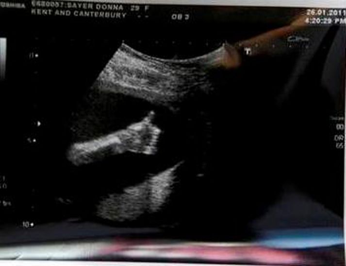 Thumbs Up!