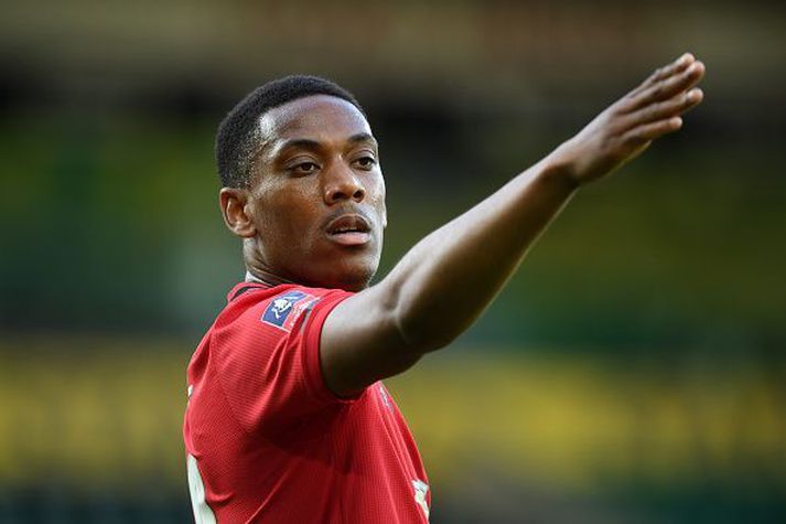 Anthony Martial baðar út höndum.