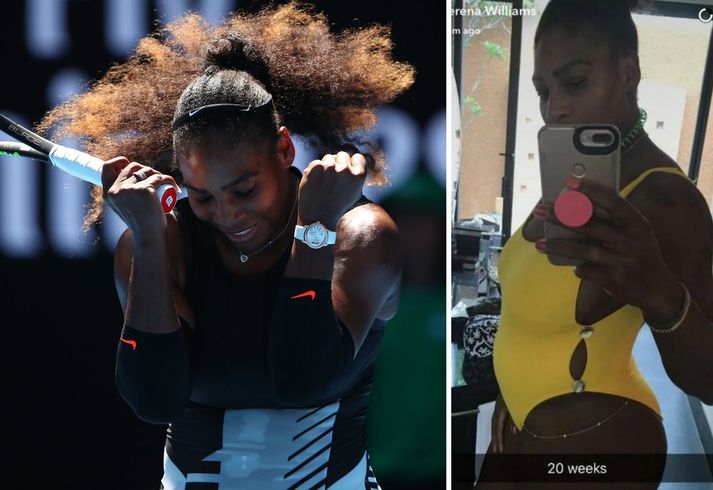 Serena Williams vann opna ástralska meistaramótið ólétt.