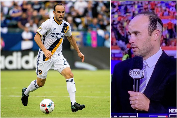 Hárígræðsla Landon Donovan var ekki alveg búin að jafna sig þegar hann mætti í sjónvarpið.