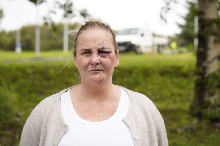 Aldís Björgvinsdóttir, íbúi í Seljahverfi, segist hafa verið út úr heiminum eftir atvikið.