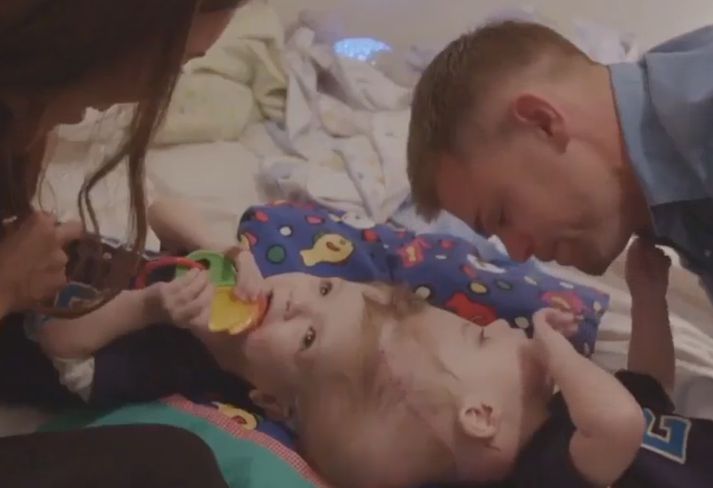 Bræðurnir Anais og Jadon ásamt foreldrum sínum fyrir aðgerðina.