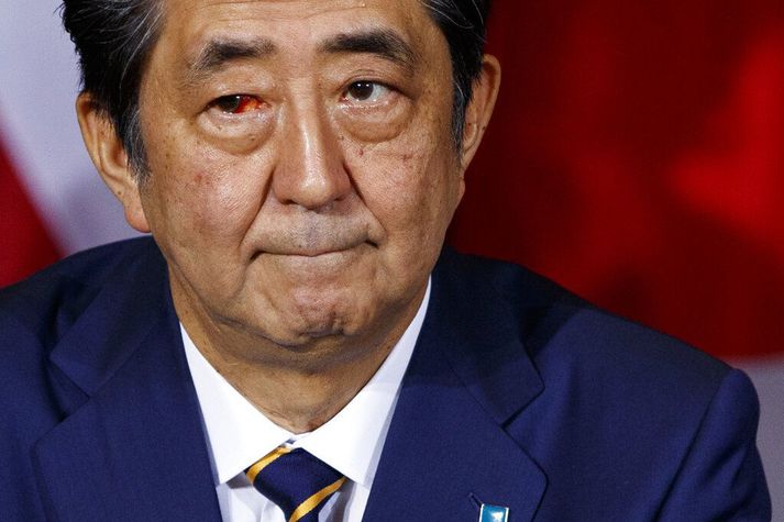 Shinzo Abe á fundi með Bandaríkjaforseta í september í fyrra. Abe hefur verið heilsuveill og talið er að hann muni segja af sér af þeim sökum í dag.