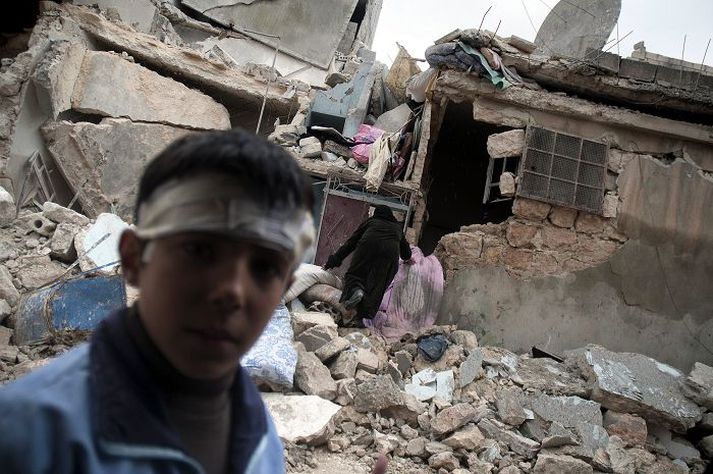 Þessi piltur í Aleppo særðist á höfði í stríðsátökum þar nýverið.