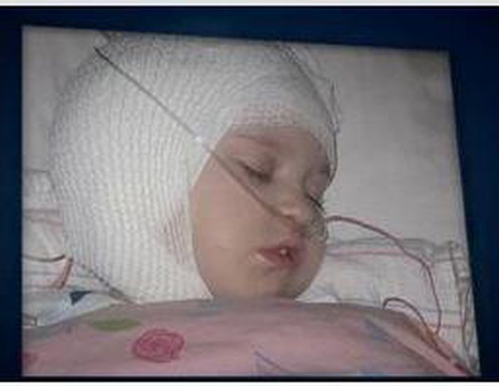 Stúlkurnar hafa verið mjög veikar og þurft að gangast undir fjölda stórra aðgerða í Boston