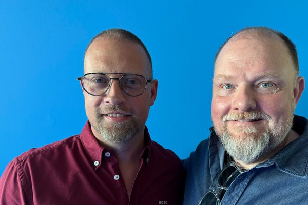 Ætla að opna umræðuna um hárígræðslur 
