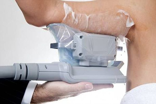 Bítið - Það er hægt að frysta af sér fituna